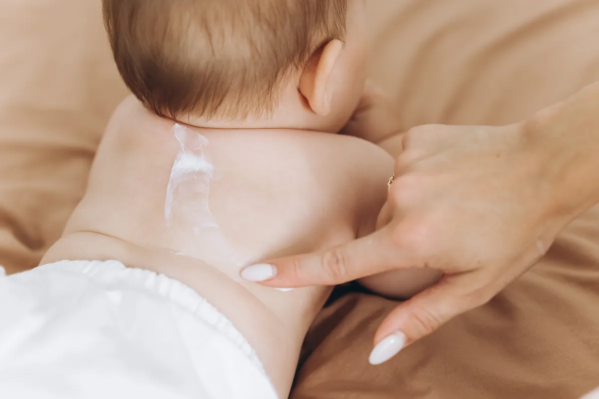Heat Rash In Babies: What Is It And How To Treat It?