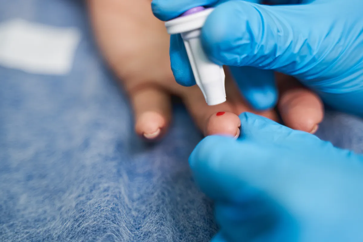 Newborn Heel Stick Test: What Is It And How Is It Done?