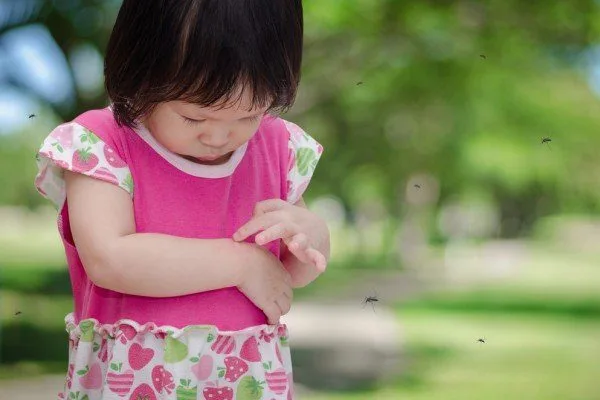 What’s the best way to treat insect bites that itch?