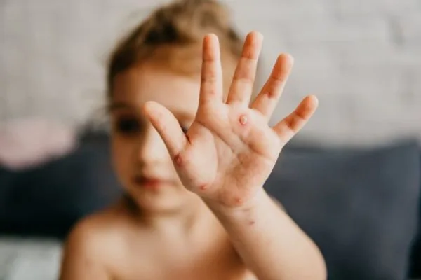 Why does my child have imaginary friends?