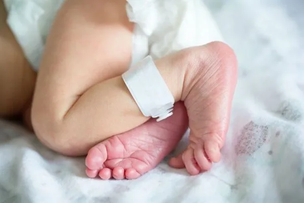 Newborn Heel Stick Test: What Is It And How Is It Done?